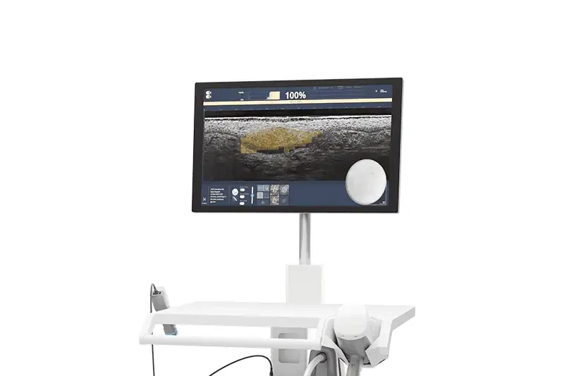 The DAMAE Medical deepLive optical imaging system, its screen showing a cross-sectional scan of skin.