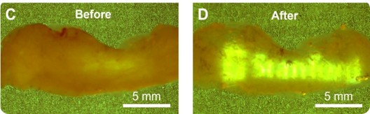 Before-and-after photographs of a skin sample made optically transparent by optical clearing (5 mm scale).